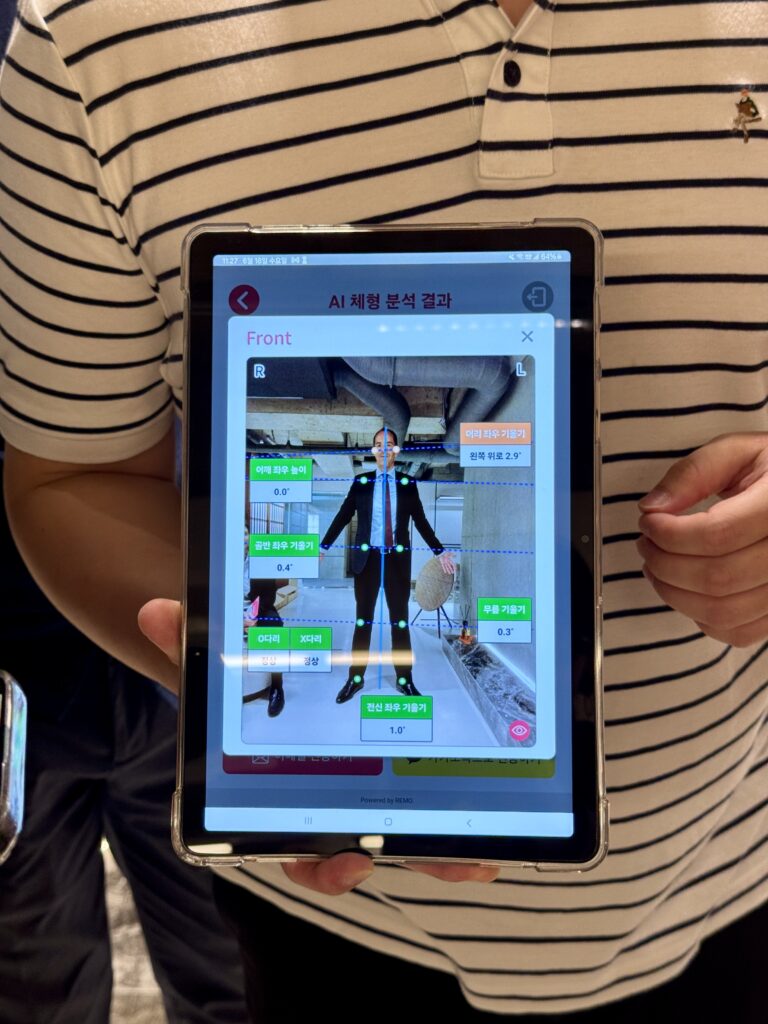 Remo: KI-gestützte Ganganalyse-Software unterstützt bei der Erstellung von Therapieplänen.